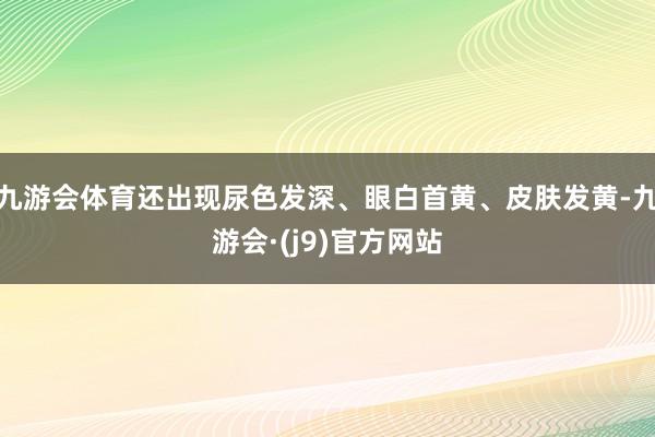 九游会体育还出现尿色发深、眼白首黄、皮肤发黄-九游会·(j9)官方网站